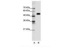 Image no. 1 for anti-Chloride Channel Kb (CLCNKB) (N-Term) antibody (ABIN6735463) (CLCNKB Antikörper  (N-Term))