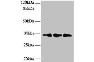 Western blot All lanes: CNOT9 antibody at 6 μg/mL Lane 1: HepG2 whole cell lysate Lane 2: Mouse small intestine tissue Lane 3: Mouse spleen tissue Secondary Goat polyclonal to rabbit IgG at 1/10000 dilution Predicted band size: 34, 37, 30 kDa Observed band size: 34 kDa (RQCD1 Antikörper  (AA 1-258))
