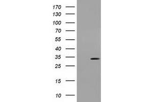 Western Blotting (WB) image for anti-Uridine-Cytidine Kinase 1 (UCK1) antibody (ABIN1501666) (UCK1 Antikörper)
