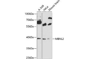 Western blot analysis of extracts of various cell lines, using MBNL2 antibody (ABIN6132336, ABIN6143603, ABIN6143604 and ABIN6216609) at 1:3000 dilution. (MBNL2 Antikörper  (AA 160-260))