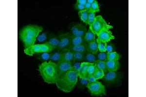 IF analysis of S100A6 using anti-S100A6 antibody (ABIN3043321). (S100A6 Antikörper  (AA 1-90))