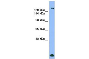 WB Suggested Anti-MYH1 Antibody Titration:  0. (MYH1 Antikörper  (N-Term))