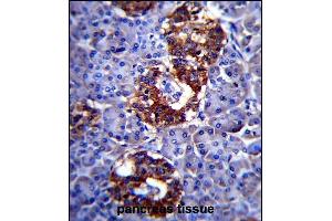 Immunohistochemistry (Paraffin-embedded Sections) (IHC (p)) image for anti-Synaptophysin (SYP) (AA 225-253), (C-Term) antibody (ABIN6242563)