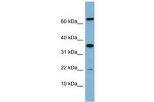 Image no. 1 for anti-RWD Domain Containing 1 (RWDD1) (AA 71-120) antibody (ABIN6741945) (RWDD1 Antikörper  (AA 71-120))