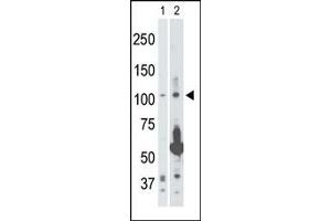 Image no. 1 for anti-Mitogen-Activated Protein Kinase Kinase Kinase 14 (MAP3K14) (Middle Region) antibody (ABIN360384) (MAP3K14 Antikörper  (Middle Region))