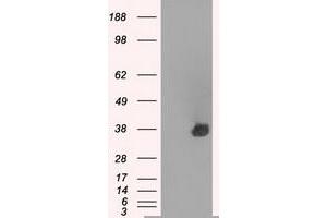Western Blotting (WB) image for anti-Aurora Kinase C (AURKC) antibody (ABIN1496783) (Aurora Kinase C Antikörper)