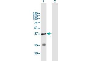 Western Blot analysis of STYXL1 expression in transfected 293T cell line by STYXL1 MaxPab polyclonal antibody. (STYXL1 Antikörper  (AA 1-313))