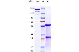 Anti-IGF1R / CD221 Reference Antibody (cixutumumab) on SDS-PAGE under reducing (R) condition.