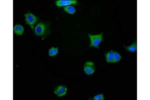Immunofluorescence staining of MCF-7 cells with ABIN7160445 at 1:200, counter-stained with DAPI. (MAG Antikörper  (AA 25-516))