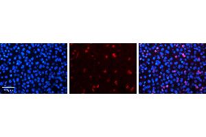 NR2F6 antibody - N-terminal region          Formalin Fixed Paraffin Embedded Tissue:  Human Liver Tissue    Observed Staining:  Nucleus in hepatocytes   Primary Antibody Concentration:  1:100    Secondary Antibody:  Donkey anti-Rabbit-Cy3    Secondary Antibody Concentration:  1:200    Magnification:  20X    Exposure Time:  0. (NR2F6 Antikörper  (N-Term))