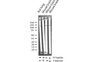 Western blot analysis of Phospho-SMC1 (Ser957) expression in various lysates (SMC1A Antikörper  (pSer957))