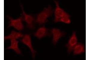 ABIN6276100 staining Hela by IF/ICC. (OR6C70 Antikörper  (C-Term))