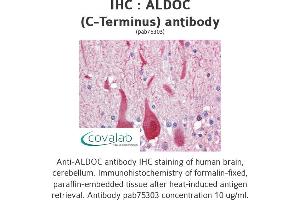 Image no. 1 for anti-Aldolase C, Fructose-Bisphosphate (ALDOC) (C-Term) antibody (ABIN2852410) (ALDOC Antikörper  (C-Term))