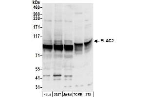 anti-ElaC Homolog 2 (ELAC2) (AA 776-826) antibody