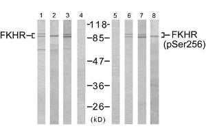 Western blot analysis using FKHR (Ab-256) antibody (E021138, Lane 1, 2, 3 and 4) and FKHR (phospho- Ser256)antibody (E011115, Lane 5, 6, 7 and 8). (FOXO1 Antikörper  (pSer256))