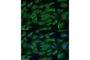 Immunofluorescence analysis of C6 cells using SHP2 antibody (ABIN6131893, ABIN6146440, ABIN6146441 and ABIN7101402) at dilution of 1:100. (PTPN11 Antikörper  (AA 1-460))