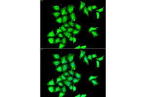 Immunofluorescence analysis of HeLa cell using MSRB1 antibody. (MSRB1 Antikörper)