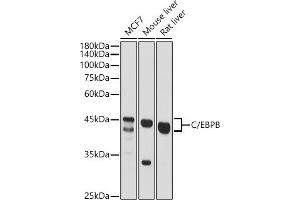 Western blot analysis of extracts of various cell lines, using C/EBPB antibody (ABIN6134025, ABIN6138382, ABIN6138383 and ABIN6213964) at 1:500 dilution. (CEBPB Antikörper  (AA 150-250))