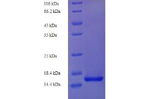 SDS-PAGE (SDS) image for Vascular Endothelial Growth Factor C (VEGFC) (AA 108-223) protein (His tag) (ABIN5713940)