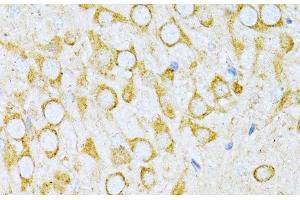 Immunohistochemistry of paraffin-embedded Rat brain using VARS Polyclonal Antibody at dilution of 1:100 (40x lens). (VARS Antikörper)