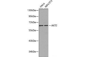 Western blot analysis of extracts of various cell lines using AKT2 Polyclonal Antibody. (AKT2 Antikörper)
