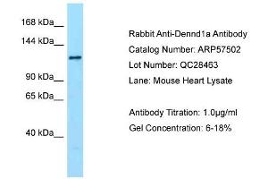 Western Blotting (WB) image for anti-DENN/MADD Domain Containing 1A (DENND1A) (C-Term) antibody (ABIN2787247) (DENND1A Antikörper  (C-Term))