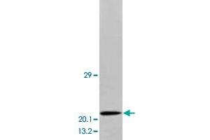 Western blot analysis of human brain tissue extracts with BDNF polyclonal antibody . (BDNF Antikörper  (Middle Region))