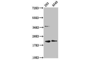 Western Blot Positive WB detected in: 293 whole cell lysate, A549 whole cell lysate All lanes: HIST1H1C antibody at 1:100 Secondary Goat polyclonal to rabbit IgG at 1/50000 dilution Predicted band size: 22 kDa Observed band size: 22 kDa (HIST1H1C Antikörper  (meLys45))