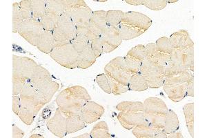 ABIN7093301 and ABIN7097320 at 1/100 staining Mouse muscle tissue by IHC-P. (Claudin 6 Antikörper  (pTyr219))