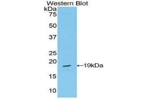 Western Blotting (WB) image for anti-Periostin (POSTN) (AA 659-810) antibody (ABIN1860276)