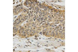 Immunohistochemistry (IHC) image for anti-Polo-Like Kinase 1 (PLK1) (AA 304-603) antibody (ABIN3023352) (PLK1 Antikörper  (AA 304-603))