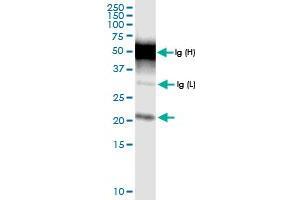 Immunoprecipitation of TMEM126B transfected lysate using anti-TMEM126B MaxPab rabbit polyclonal antibody and Protein A Magnetic Bead , and immunoblotted with TMEM126B MaxPab rabbit polyclonal antibody (D01) . (TMEM126B Antikörper  (AA 1-200))