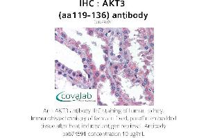 Image no. 2 for anti-V-Akt Murine Thymoma Viral Oncogene Homolog 3 (Protein Kinase B, Gamma) (AKT3) (AA 119-136) antibody (ABIN1731657)