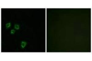 Immunofluorescence analysis of HepG2 cells, using MUC16 antibody. (MUC16 Antikörper)