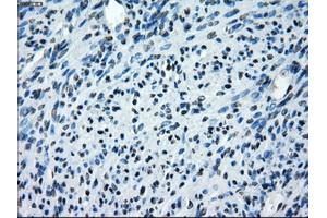 Immunohistochemistry (IHC) image for anti-SATB Homeobox 1 (SATB1) antibody (ABIN1500810) (SATB1 Antikörper)