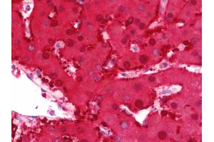 Anti-DDH / AKR1C1 antibody IHC staining of human liver. (AKR1C1 Antikörper  (AA 22-248))