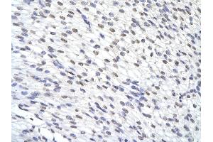 Rabbit Anti-ZFP36 antibody        Paraffin Embedded Tissue:  Human Heart cell   Cellular Data:  Epithelial cells of renal tubule  Antibody Concentration:   4. (ZFP36 Antikörper  (N-Term))