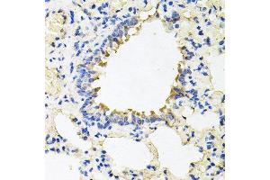 Immunohistochemistry of paraffin-embedded rat lung using CALU antibody at dilution of 1:100 (x40 lens). (CALU Antikörper)