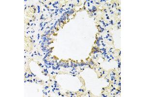 Immunohistochemistry of paraffin-embedded rat lung using CALU antibody at dilution of 1:100 (x40 lens).