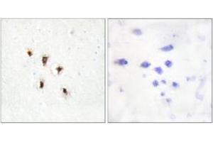 Immunohistochemistry analysis of paraffin-embedded human brain tissue, using Mevalonate Kinase Antibody. (MVK Antikörper  (AA 151-200))