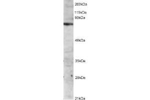 Western Blotting (WB) image for IL2-Inducible T-Cell Kinase (ITK) peptide (ABIN369790) (IL2-Inducible T-Cell Kinase (ITK) Peptid)