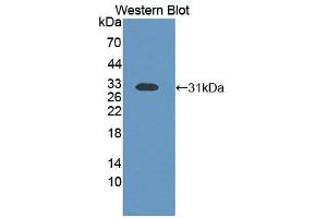 Western blot analysis of recombinant Human ETFb. (ETFB Antikörper  (AA 2-255))
