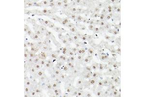 Immunohistochemistry (IHC) image for anti-Leo1, Paf1/RNA Polymerase II Complex Component, Homolog (S. Cerevisiae) (LEO1) antibody (ABIN6133790)
