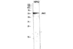 Western Blotting (WB) image for anti-V-Akt Murine Thymoma Viral Oncogene Homolog 1 (AKT1) (N-Term) antibody (ABIN3183239) (AKT1 Antikörper  (N-Term))