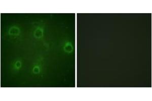Immunofluorescence analysis of COS7 cells, using IL-8R beta/CDw128 beta (Phospho-Ser347) Antibody. (CXCR2 Antikörper  (pSer347))