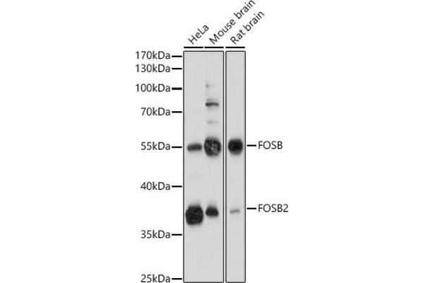 FOSB Antikörper  (AA 1-100)