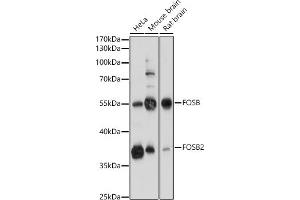 Western blot analysis of extracts of various cell lines, using FOSB antibody (ABIN7267159) at 1:1000 dilution. (FOSB Antikörper  (AA 1-100))