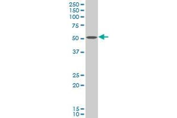 Choline Kinase alpha Antikörper  (AA 294-393)