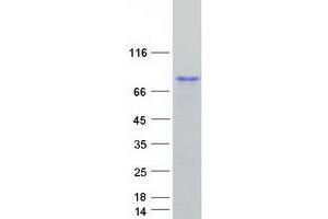 Validation with Western Blot