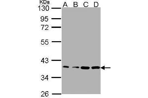 WB Image Sample(30μg whole cell lysate) A: A431 , B: H1299 C: HeLaS3 D: MOLT4 , 12% SDS PAGE antibody diluted at 1:1000 (RPL5 Antikörper)